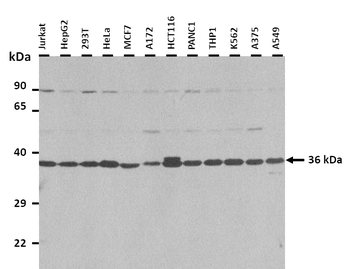 APEX1 Rabbit Polyclonal Antibody