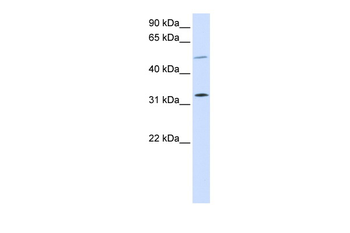 SHOX2 Rabbit Polyclonal Antibody
