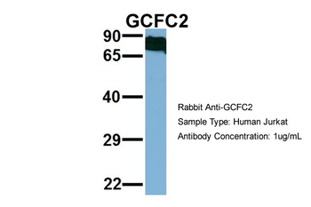 C2orf3 Rabbit Polyclonal Antibody