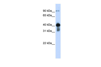 USF2 Rabbit Polyclonal Antibody