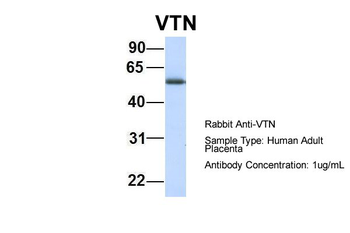 VTN Rabbit Polyclonal Antibody