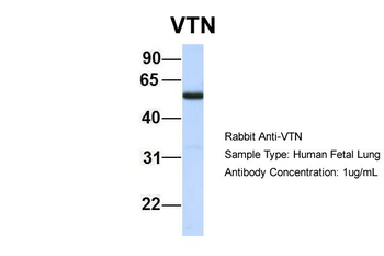 VTN Rabbit Polyclonal Antibody