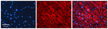 CALR Rabbit Polyclonal Antibody
