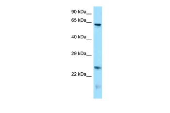 Runx1t1 Rabbit Polyclonal Antibody