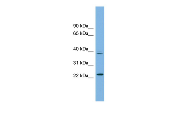TFDP3 Rabbit Polyclonal Antibody