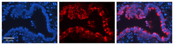 KRT7 Rabbit Polyclonal Antibody