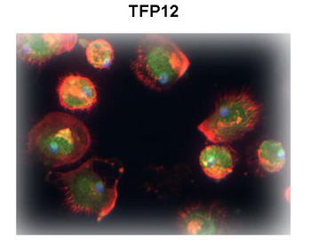 TFPI2 Rabbit Polyclonal Antibody