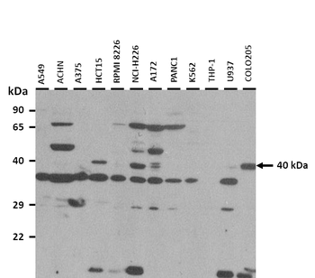 H2AFY Rabbit Polyclonal Antibody