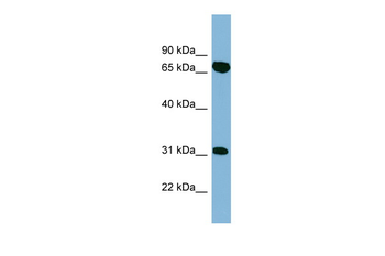 HIRIP3 Rabbit Polyclonal Antibody