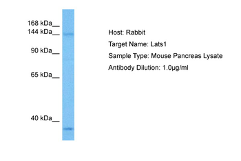 LATS1 Rabbit Polyclonal Antibody