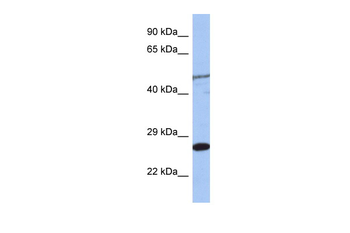 MIS12 Rabbit Polyclonal Antibody