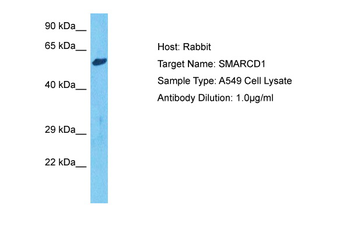 SMARCD1 Rabbit Polyclonal Antibody