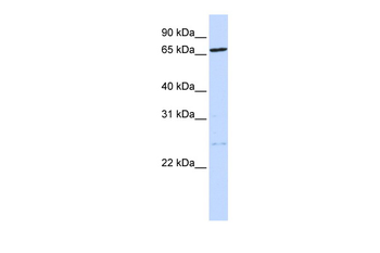 TLK1 Rabbit Polyclonal Antibody