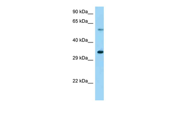 Usp27x Rabbit Polyclonal Antibody