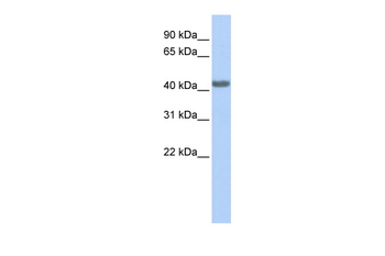 CCR2 Rabbit Polyclonal Antibody