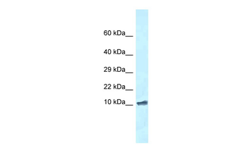 Romo1 Rabbit Polyclonal Antibody