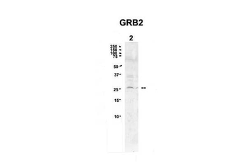 GRB2 Rabbit Polyclonal Antibody