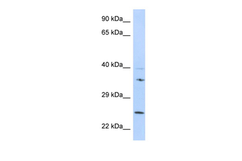 GRB2 Rabbit Polyclonal Antibody
