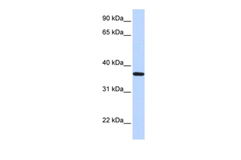 LCN12 Rabbit Polyclonal Antibody