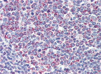 PGLS Rabbit Polyclonal Antibody