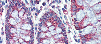 PGLS Rabbit Polyclonal Antibody