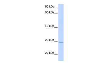 XRCC2 Rabbit Polyclonal Antibody
