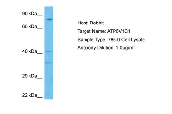 ATP6V1C1 Rabbit Polyclonal Antibody