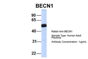 BECN1 Rabbit Polyclonal Antibody