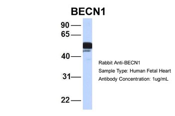 BECN1 Rabbit Polyclonal Antibody