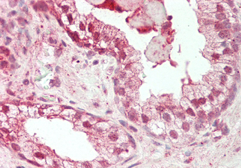 BECN1 Rabbit Polyclonal Antibody