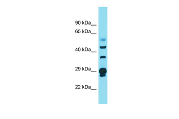 CRYL1 Rabbit Polyclonal Antibody