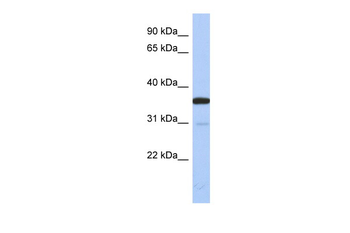 ESD Rabbit Polyclonal Antibody
