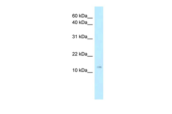 Stmn1 Rabbit Polyclonal Antibody