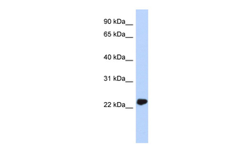 UCHL3 Rabbit Polyclonal Antibody