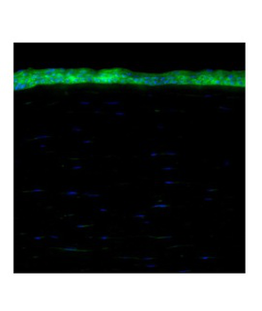 ALDH1A1 Rabbit Polyclonal Antibody