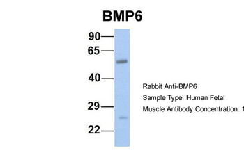 BMP6 Rabbit Polyclonal Antibody