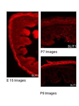 SLIT1 Rabbit Polyclonal Antibody