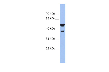 WNT3A Rabbit Polyclonal Antibody