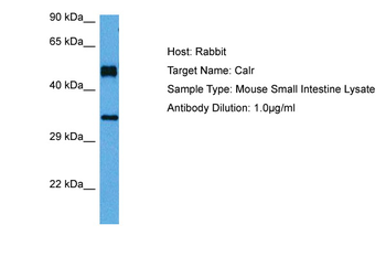 CALR Rabbit Polyclonal Antibody
