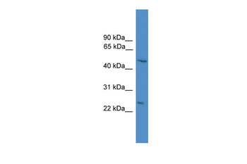 DRAM Rabbit Polyclonal Antibody