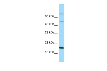 GABARAPL1 Rabbit Polyclonal Antibody