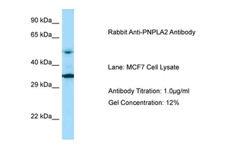 PNPLA2 Rabbit Polyclonal Antibody