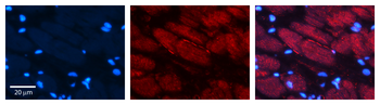 PNPLA2 Rabbit Polyclonal Antibody