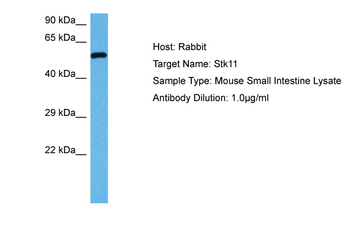 STK11 Rabbit Polyclonal Antibody
