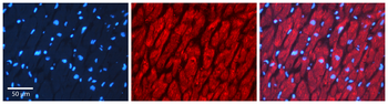 STK11 Rabbit Polyclonal Antibody
