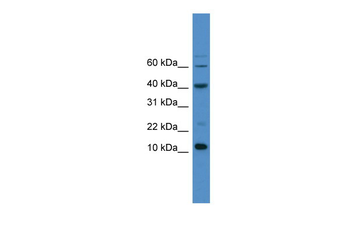 CASP3 Rabbit Polyclonal Antibody