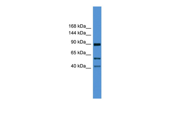 TLR2 Rabbit Polyclonal Antibody