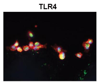 TLR4 Rabbit Polyclonal Antibody
