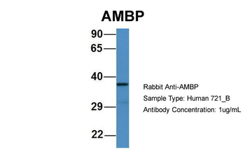AMBP Rabbit Polyclonal Antibody