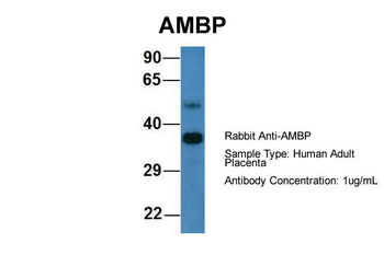 AMBP Rabbit Polyclonal Antibody